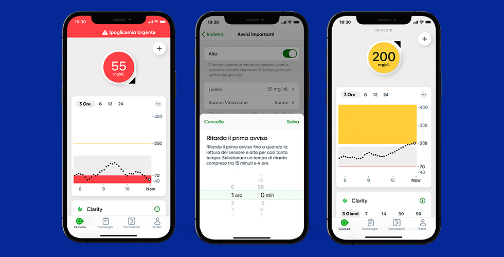 Maggiore visibilità dei dati con l’App Dexcom